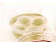 �΂��L�@��z�P�[�u���e���r��